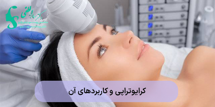 کرایوتراپی