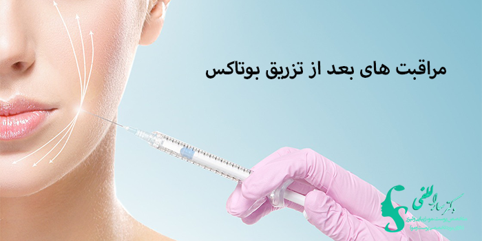 مراقبت های بعد از تزریق بوتاکس