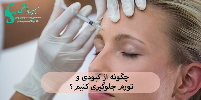 چگونه از کبودی و تورم جلوگیری کنیم؟