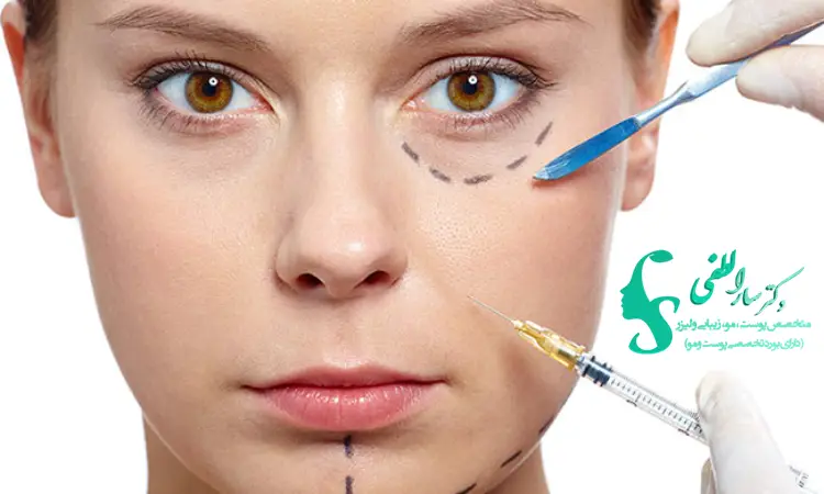 تزریق بوتاکس صورت چیست؟