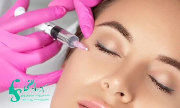 مراقبت های بعد از تزریق بوتاکس