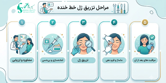 نحوه تزریق ژل به خط خنده