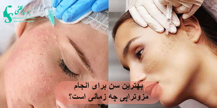 بهترین سن برای انجام مزوتراپی چه زمانی است؟
