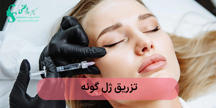 تزریق ژل گونه