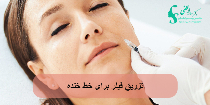 تزریق فیلر برای خط خنده