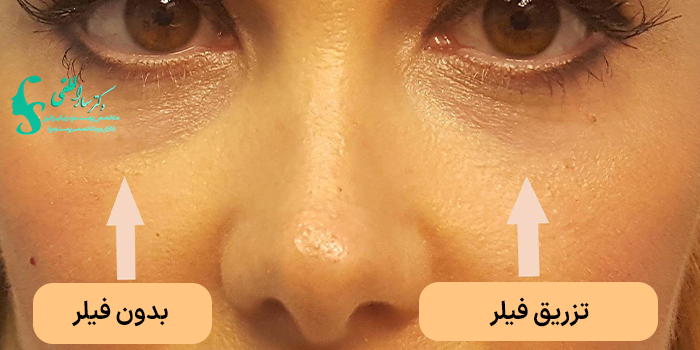 مدت زمان بهبودی