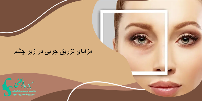 مزایای تزریق چربی در زیر چشم چیست؟