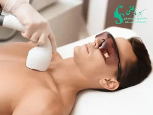 بهترین سن برای لیزر موهای زائد
