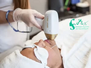 بهترین دستگاه لیزر موهای زائد