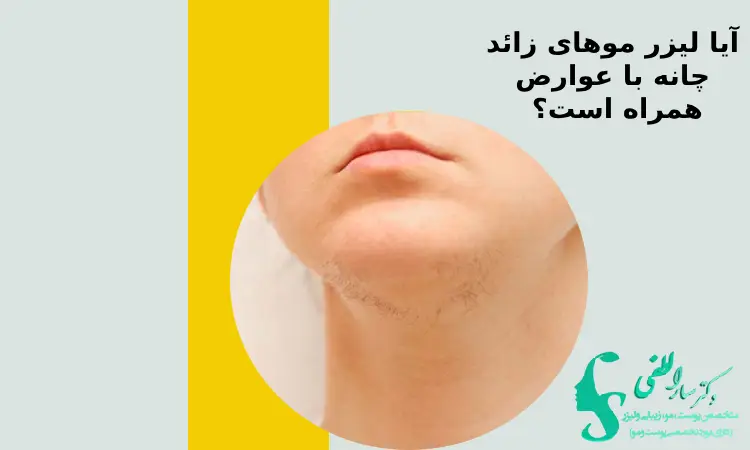 علت رویش موهای زائد چانه