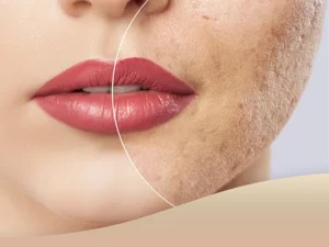 مراقبت های بعد از سابسیژن