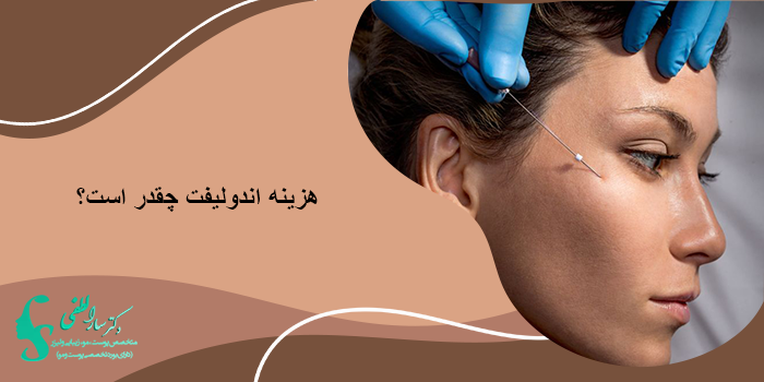 هزینه اندولیفت