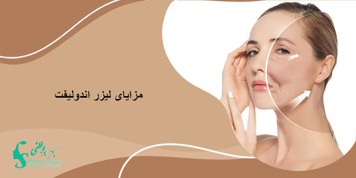 اقدامات قبل از انجام اندولیفت