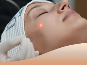 مراقبت های بعد از اندولیفت