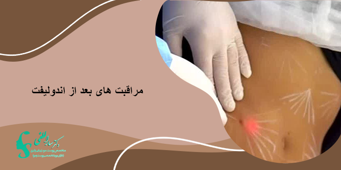 مراقبت های بعد از اندولیفت