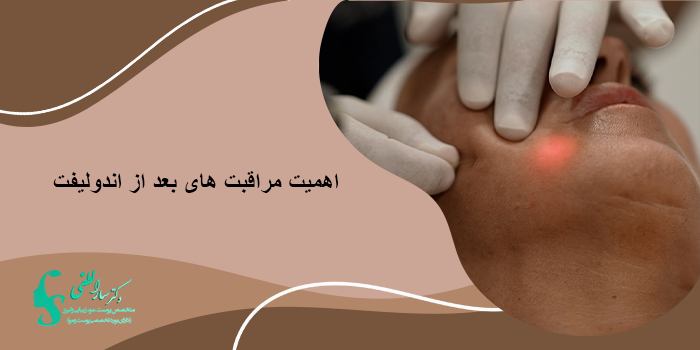 چرا مراقبت های بعد از اندولیفت اهمیت دارد؟