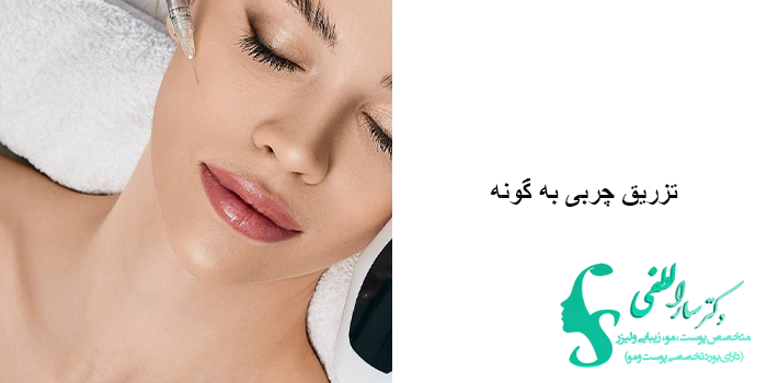 تزریق چربی به گونه