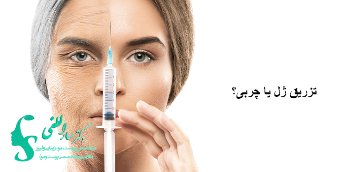 تزریق ژل یا چربی
