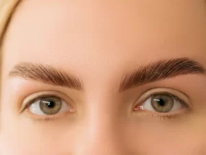 تزریق فیلر ابرو