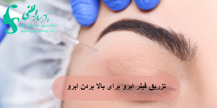 تزریق فیلر ابرو