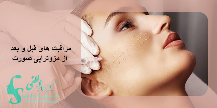 مراقبت های قبل و بعد از مزوتراپی صورت