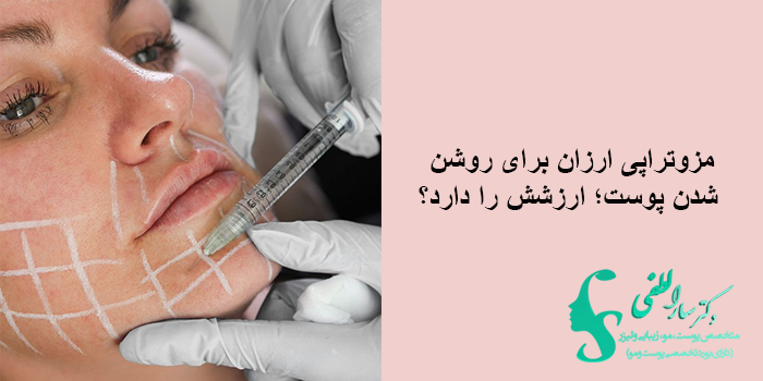 مزوتراپی ارزان برای روشن شدن پوست؛ ارزشش را دارد؟