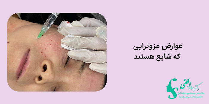 عوارض مزوتراپی