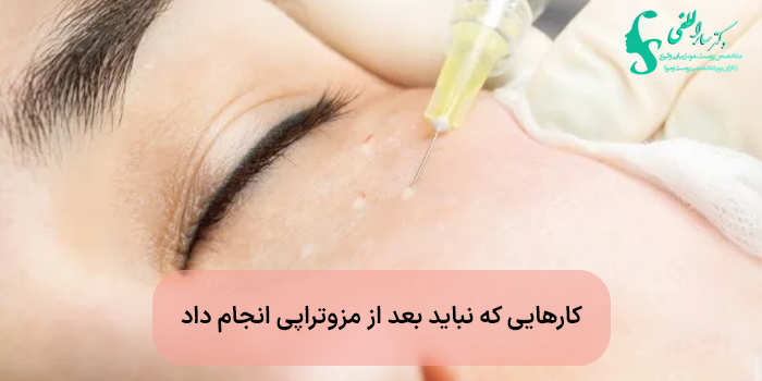 کارهایی که نباید بعد از مزوتراپی انجام داد