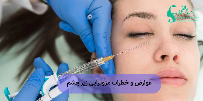 عوارض و خطرات مزوتراپی زیر چشم