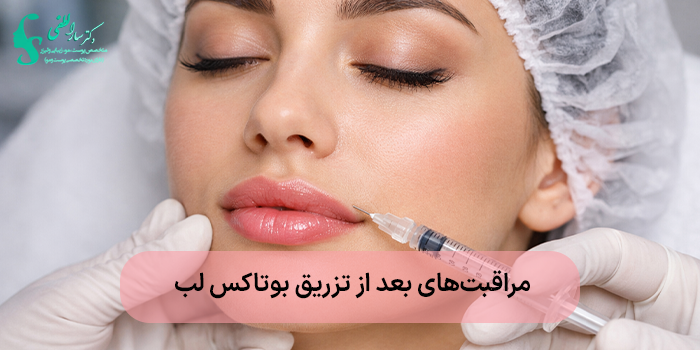 مراقبتهای بعد از تزریق بوتاکس لب