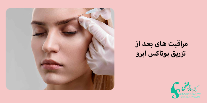 مراقبت های بعد از بوتاکس ابرو