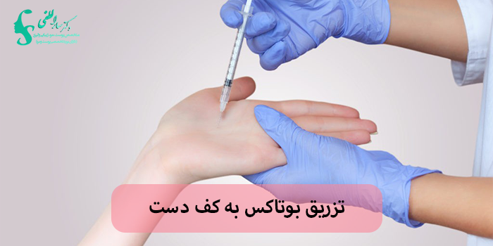 تزریق بوتاکس به کف دست